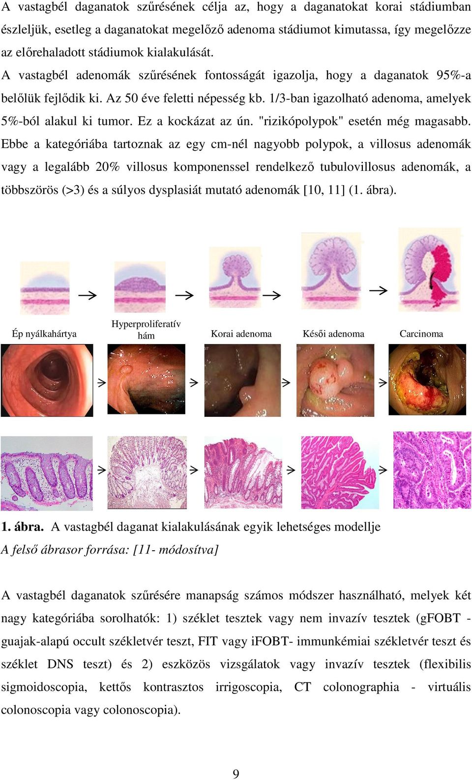 1/3-ban igazolható adenoma, amelyek 5%-ból alakul ki tumor. Ez a kockázat az ún. "rizikópolypok" esetén még magasabb.