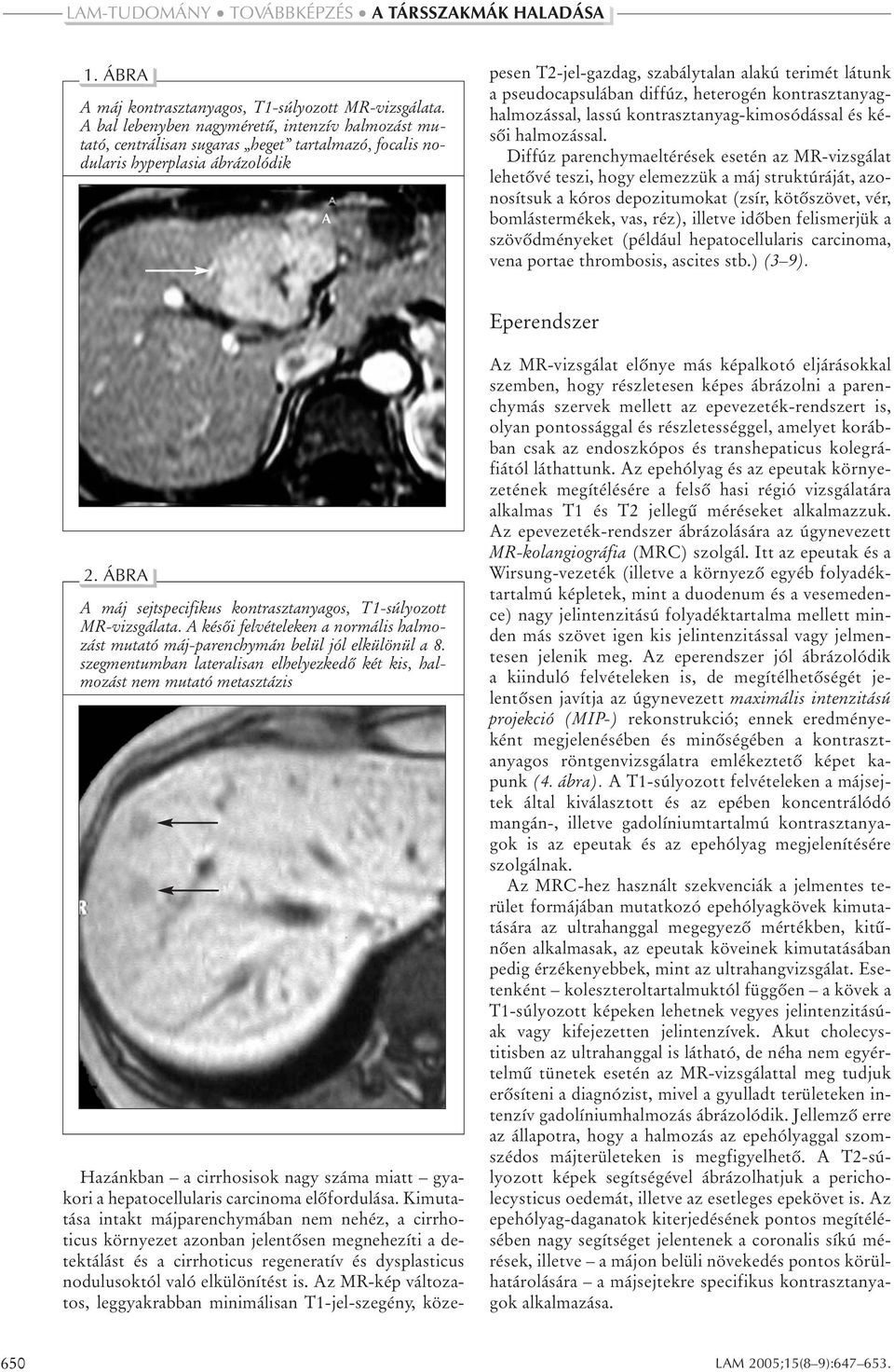 hepatocellularis carcinoma elôfordulása.