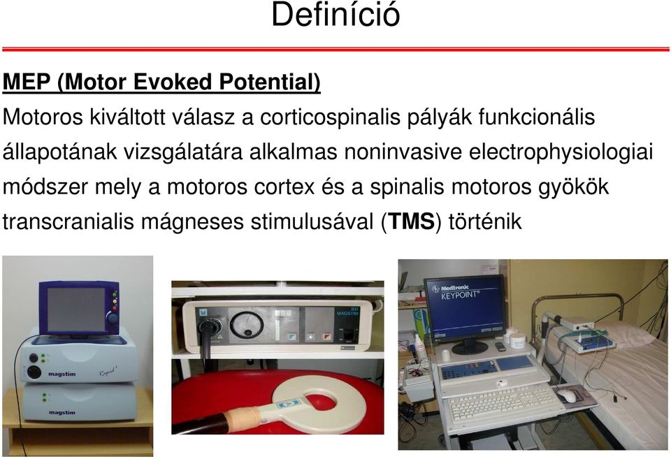 noninvasive electrophysiologiai módszer mely a motoros cortex és a