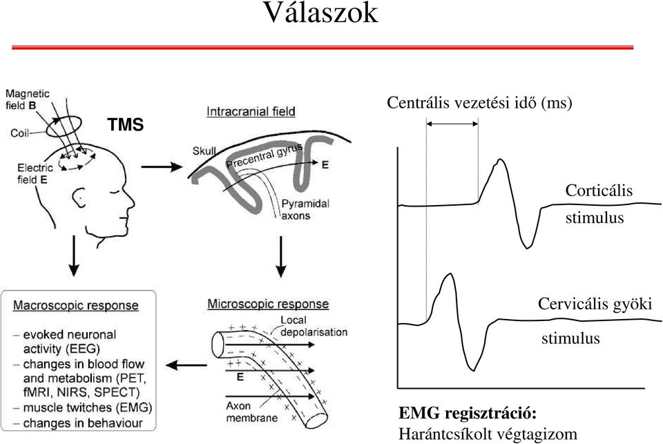 Cervicális gyöki stimulus EMG