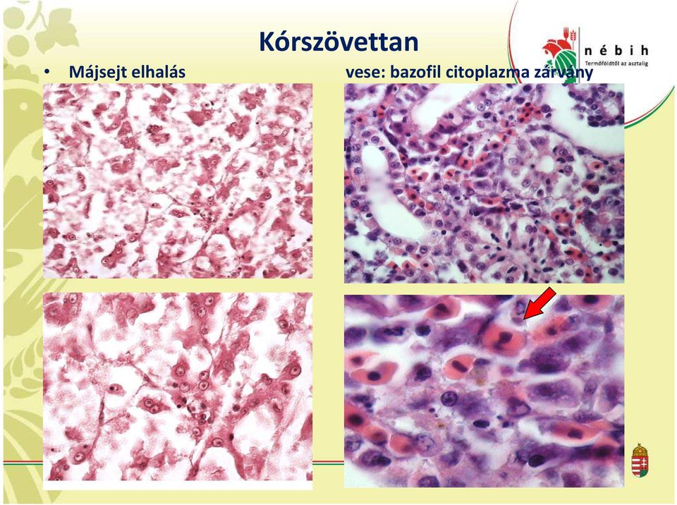 vese: bazofil