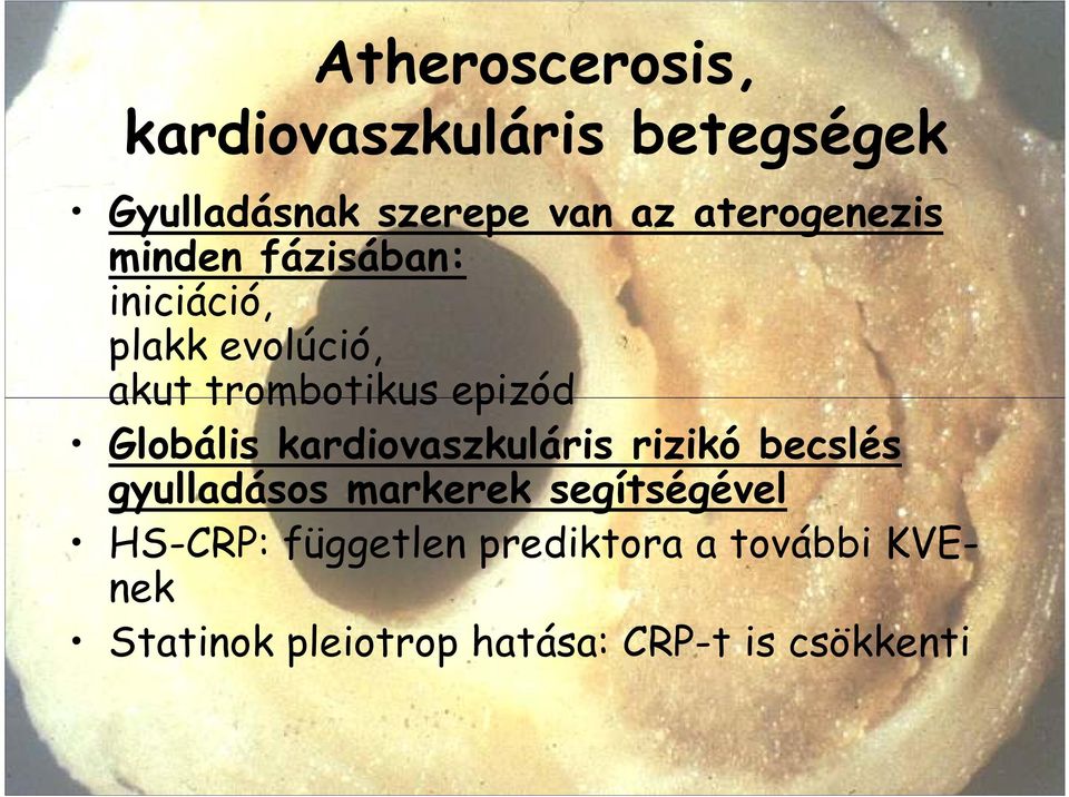 epizód Globális kardiovaszkuláris rizikó becslés gyulladásos markerek
