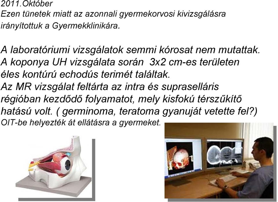 A koponya UH vizsgálata során 3x2 cm-es területen éles kontúrú echodús terimét találtak.