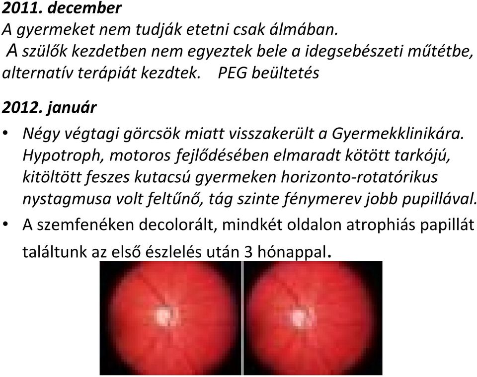 január Négy végtagi görcsök miatt visszakerült a Gyermekklinikára.