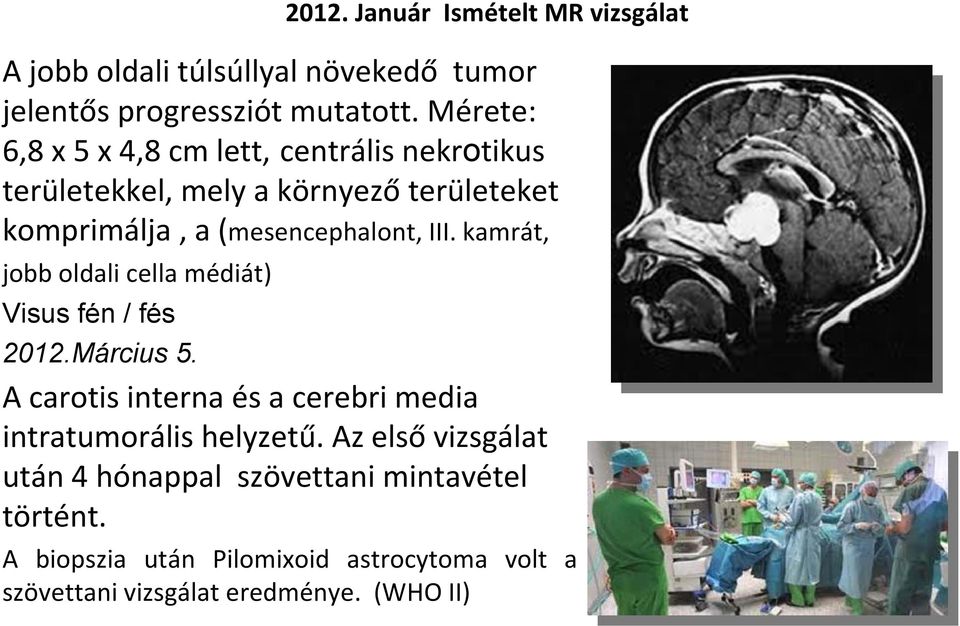 kamrát, jobb oldali cella médiát) Visus fén / fés 2012.Március 5. A carotis interna és a cerebri media intratumorális helyzetű.