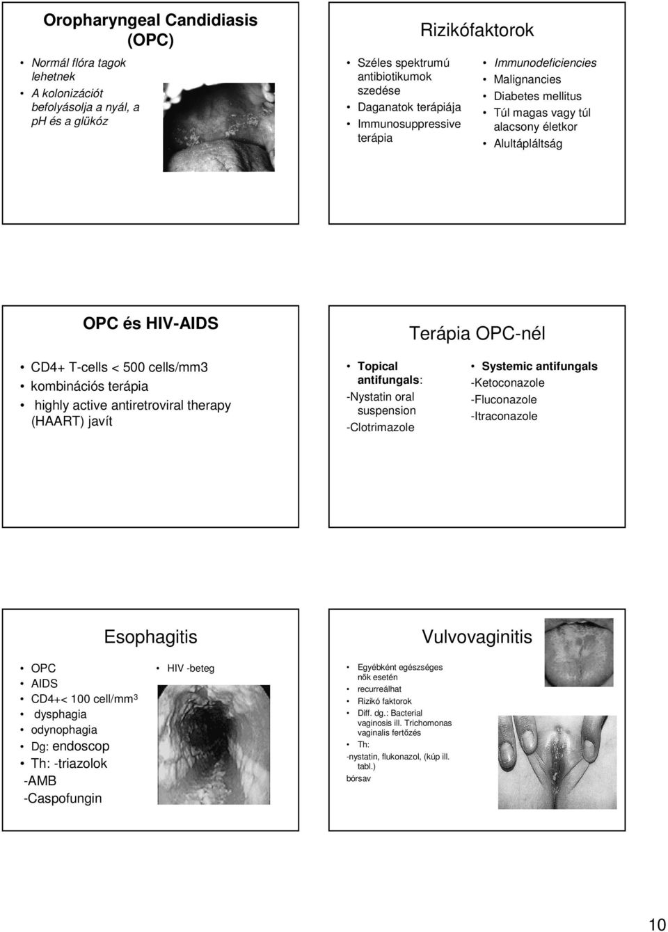 terápia highly active antiretroviral therapy (HAART) javít Topical antifungals: -Nystatin oral suspension -Clotrimazole Systemic antifungals -Ketoconazole -Fluconazole -Itraconazole Esophagitis