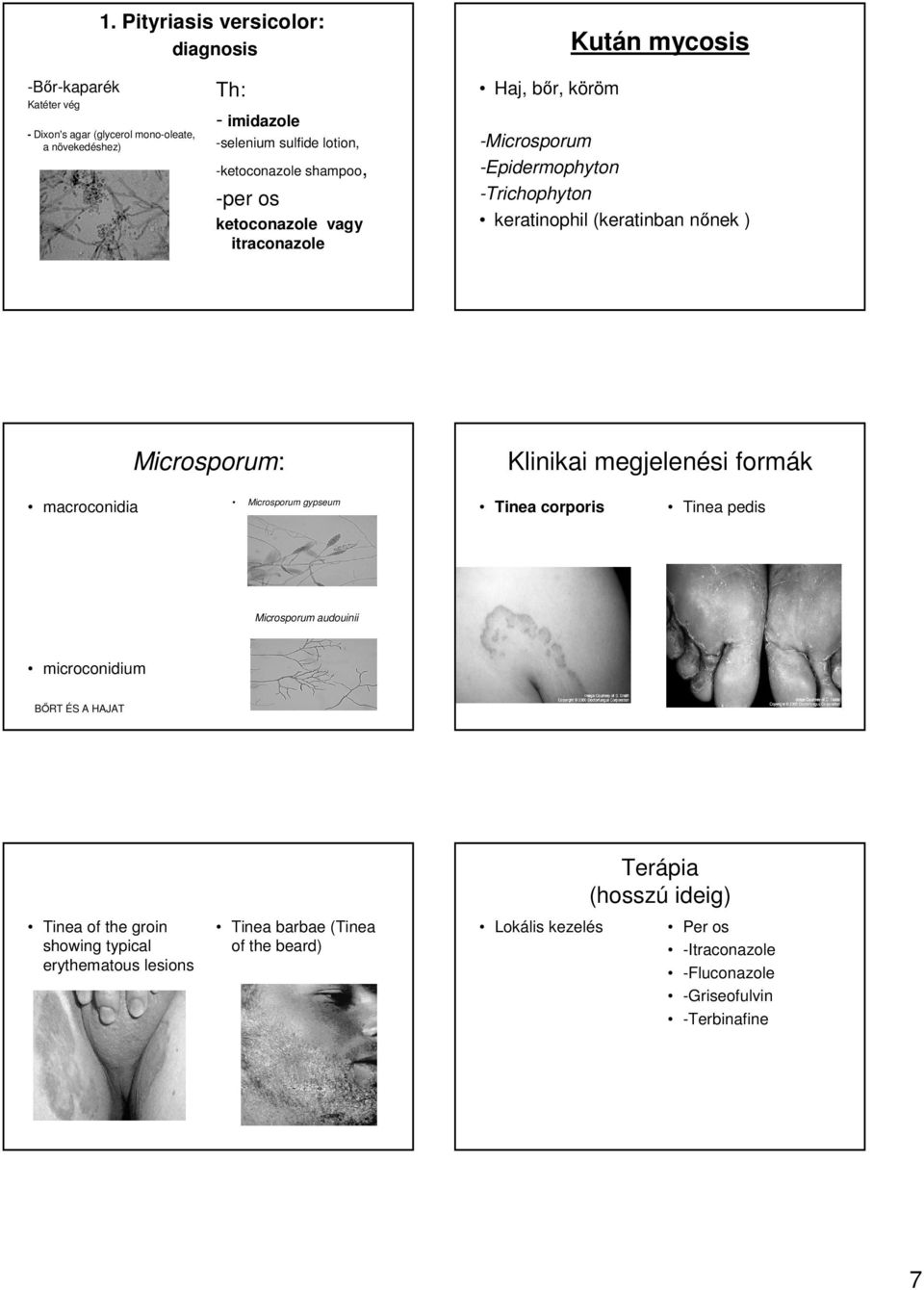 Microsporum: Klinikai megjelenési formák macroconidia Microsporum gypseum Tinea corporis Tinea pedis Microsporum audouinii microconidium BŐRT ÉS A HAJAT Terápia