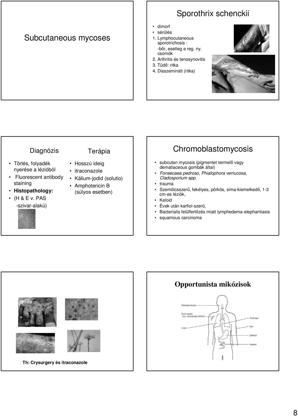 PAS -szivar-alakú) Terápia Hosszú ideig itraconazole Kálium-jodid (solutio) Amphotericin B (súlyos esetben) Chromoblastomycosis subcutan mycosis (pigmentet termelő vagy dematiaceous gombák által)