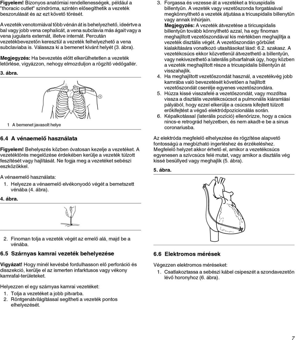 Percután vezetékbevezetőn keresztül a vezeték felhelyezhető a vena subclaviaba is. Válassza ki a bemenet kívánt helyét (3. ábra).