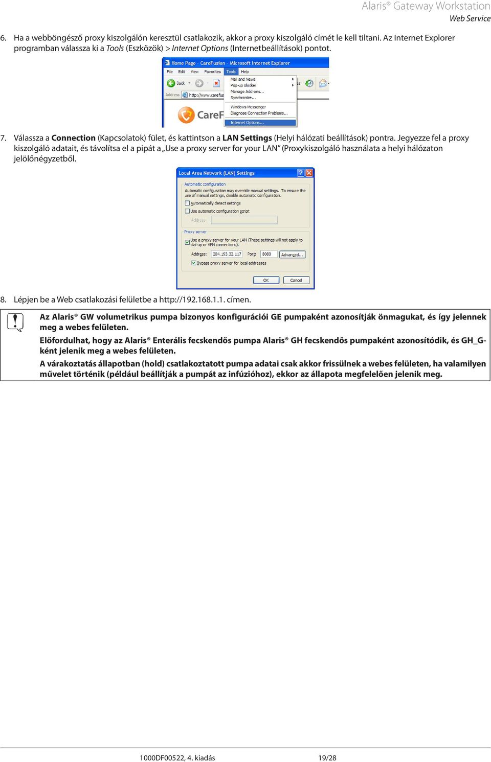 Válassza a Connection (Kapcsolatok) fület, és kattintson a LN Settings (Helyi hálózati beállítások) pontra.