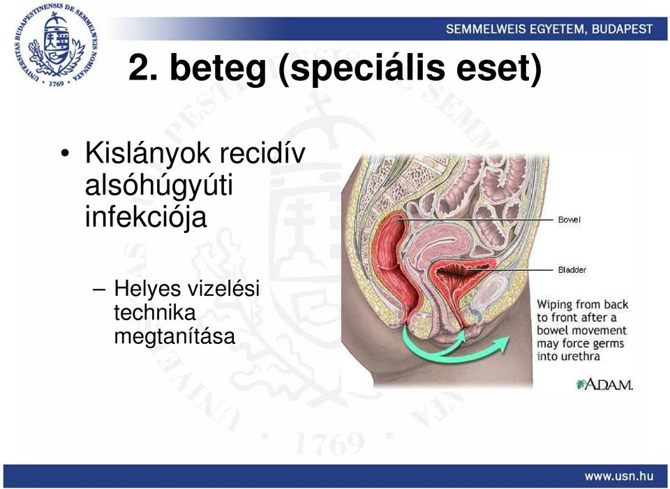 alsóhúgyúti infekciója