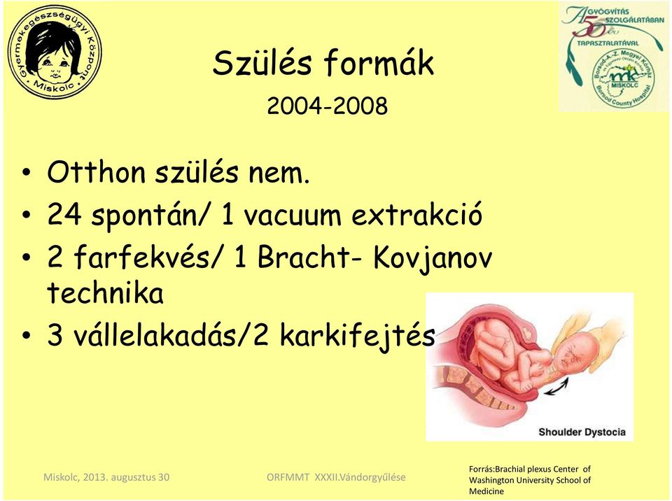 Kovjanov technika 3 vállelakadás/2 karkifejtés