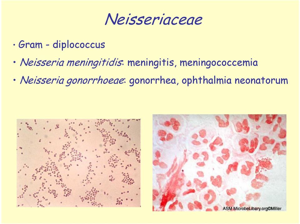 meningitis, meningococcemia