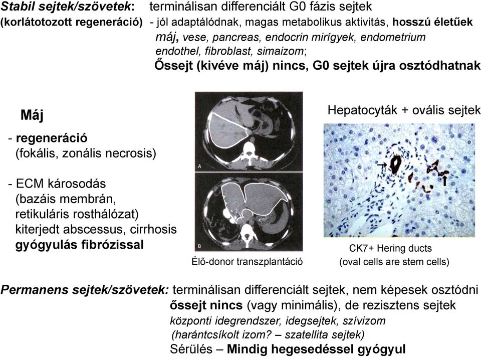 rosthálózat) kiterjedt abscessus, cirrhosis gyógyulás fibrózissal Élő-donor transzplantáció Hepatocyták + ovális sejtek CK7+ Hering ducts (oval cells are stem cells) Permanens sejtek/szövetek: