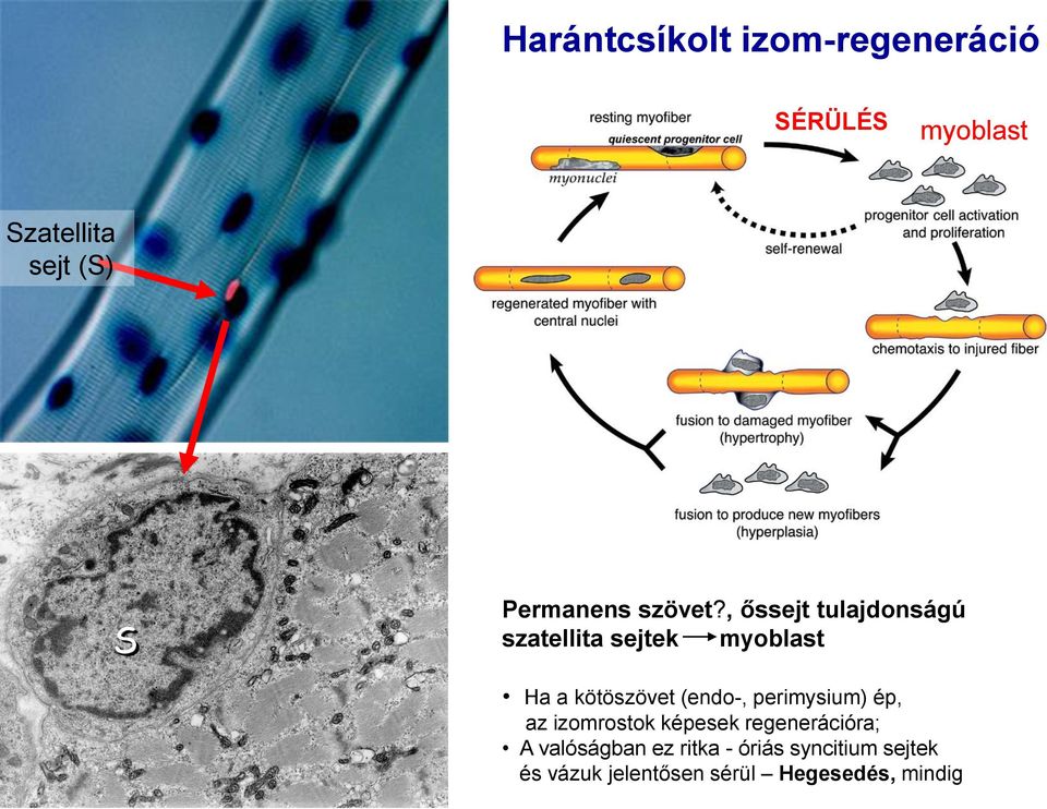 , őssejt tulajdonságú szatellita sejtek myoblast Ha a kötöszövet (endo-,