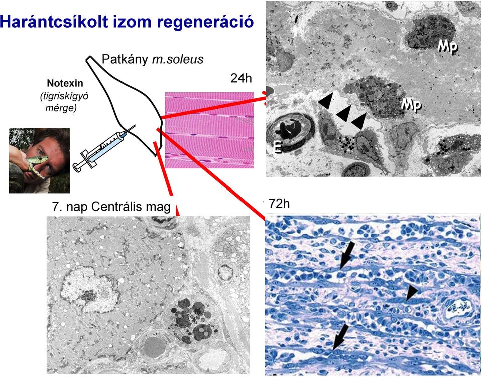 soleus Notexin (tigriskígyó