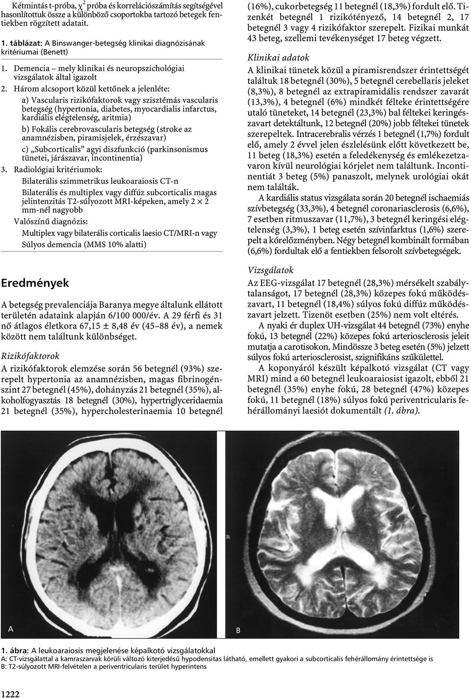 Három alcsoport közül kettőnek a jelenléte: a) Vascularis rizikófaktorok vagy szisztémás vascularis betegség (hypertonia, diabetes, myocardialis infarctus, kardiális elégtelenség, aritmia) b) Fokális