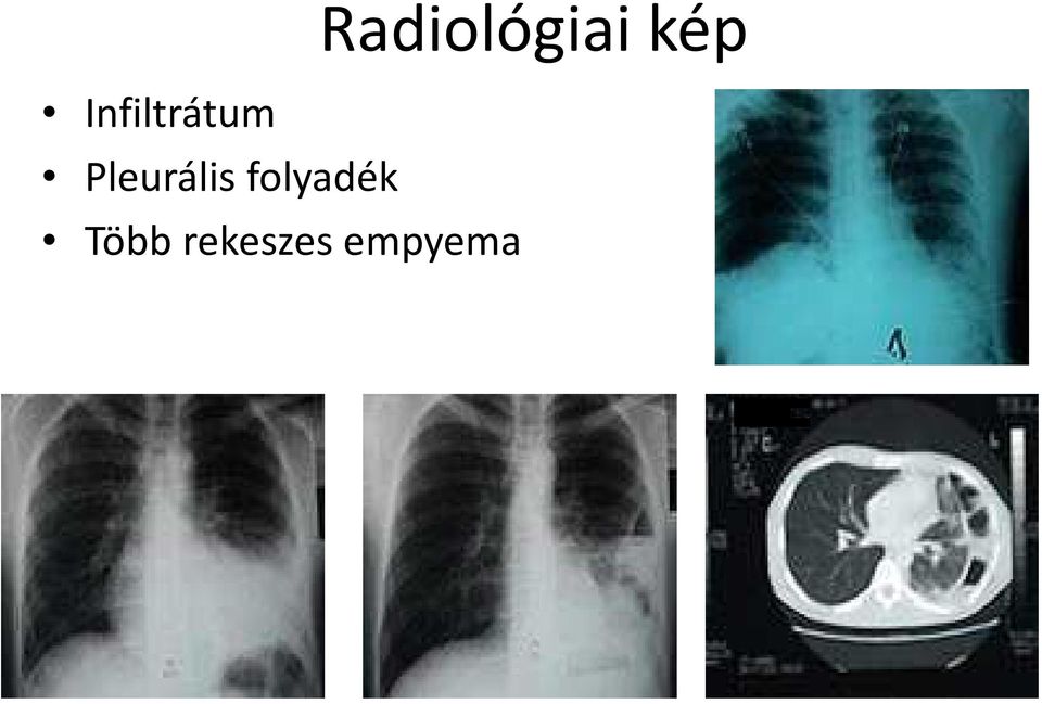 folyadék Több