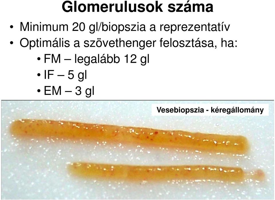 szövethenger felosztása, ha: FM legalább