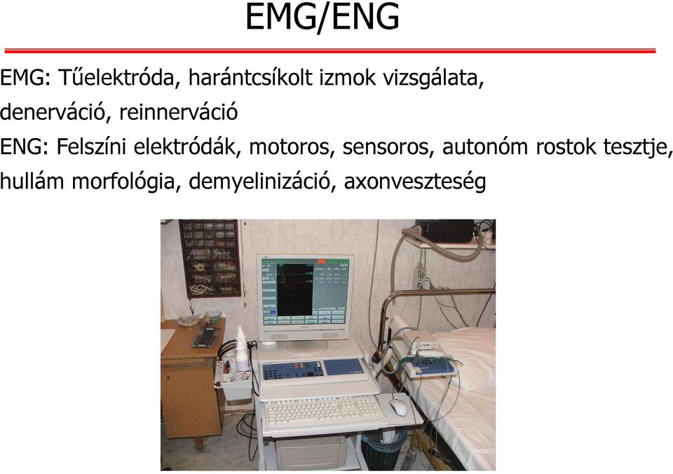 ENG: Felszíni elektródák, motoros, sensoros, autonóm