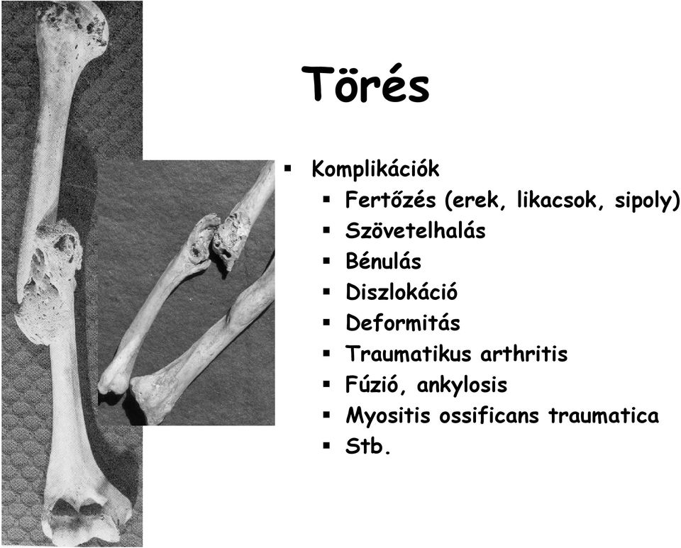 Diszlokáció Deformitás Traumatikus