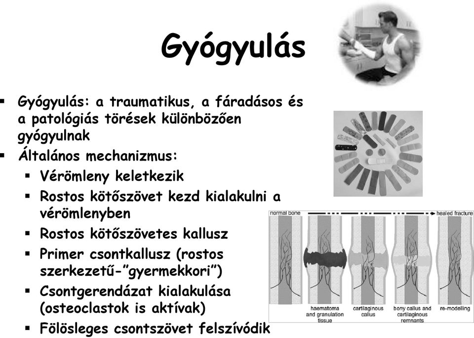 a vérömlenyben Rostos kötıszövetes kallusz Primer csontkallusz (rostos szerkezető-