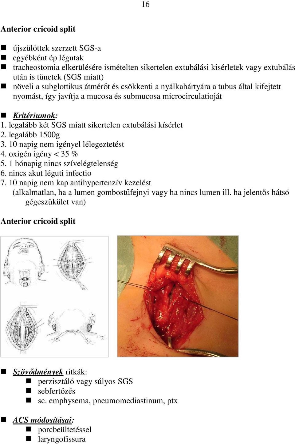 legalább két SGS miatt sikertelen extubálási kísérlet 2. legalább 1500g 3. 10 napig nem igényel lélegeztetést 4. oxigén igény < 35 % 5. 1 hónapig nincs szívelégtelenség 6.