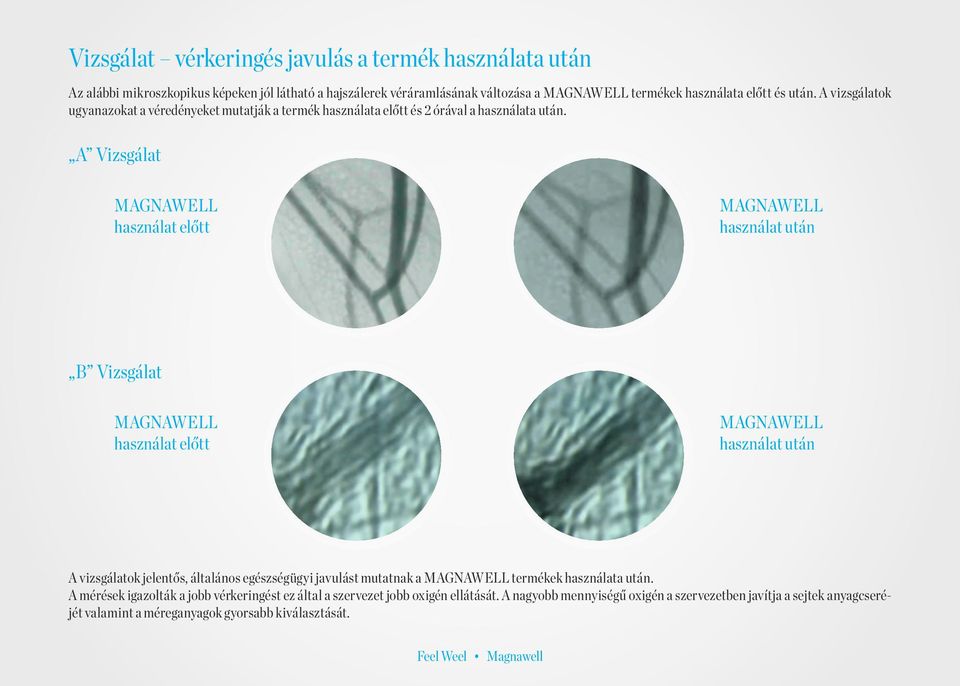 A Vizsgálat MAGNAWELL használat előtt MAGNAWELL használat után B Vizsgálat MAGNAWELL használat előtt MAGNAWELL használat után A vizsgálatok jelentős, általános egészségügyi javulást