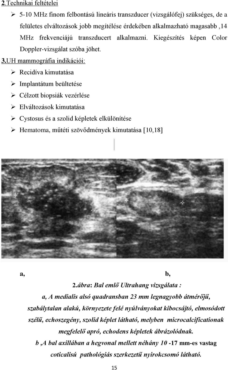 UH mammográfia indikációi: Recidíva kimutatása Implantátum beültetése Célzott biopsiák vezérlése Elváltozások kimutatása Cystosus és a szolid képletek elkülönítése Hematoma, műtéti szövődmények