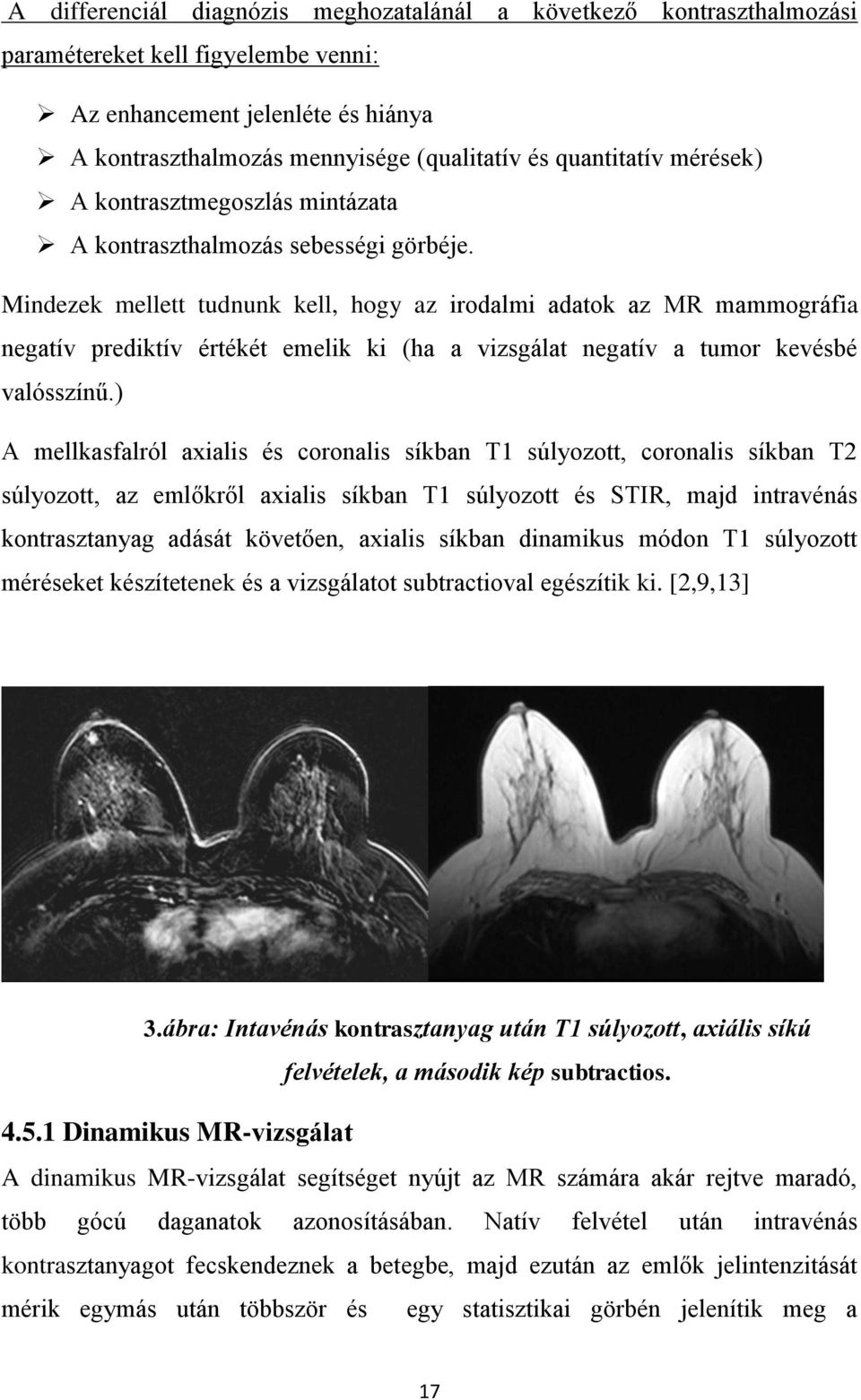 Mindezek mellett tudnunk kell, hogy az irodalmi adatok az MR mammográfia negatív prediktív értékét emelik ki (ha a vizsgálat negatív a tumor kevésbé valósszínű.