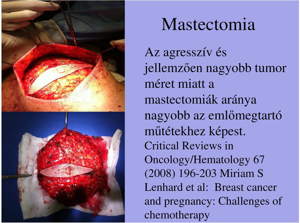 Critical Reviews in Oncology/Hematology 67 (2008) 196-203 Miriam S