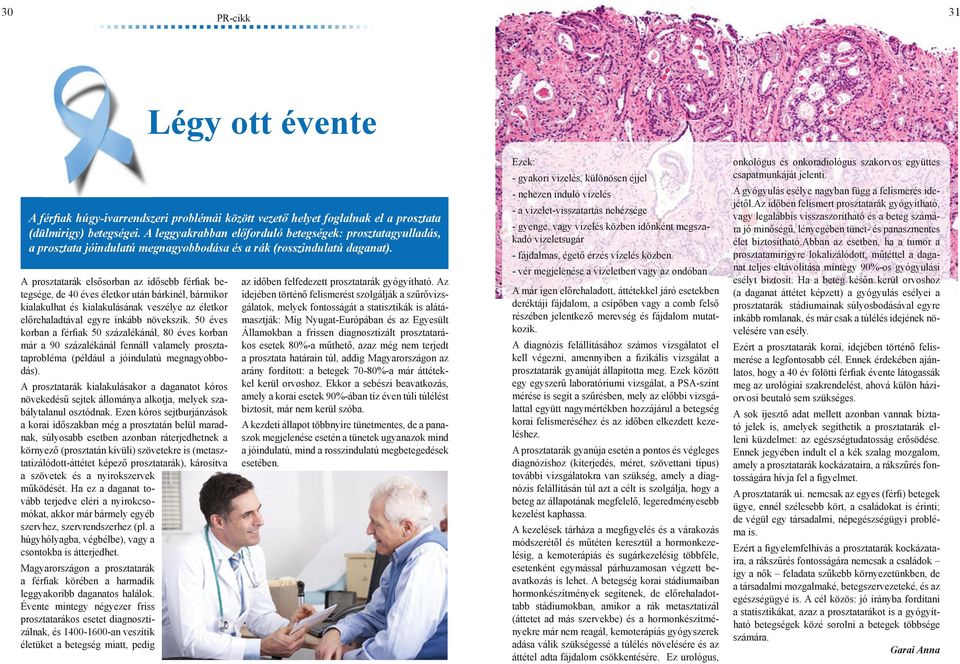 A prosztatarák elsősorban az idősebb férfiak betegsége, de 40 éves életkor után bárkinél, bármikor kialakulhat és kialakulásának veszélye az életkor előrehaladtával egyre inkább növekszik.