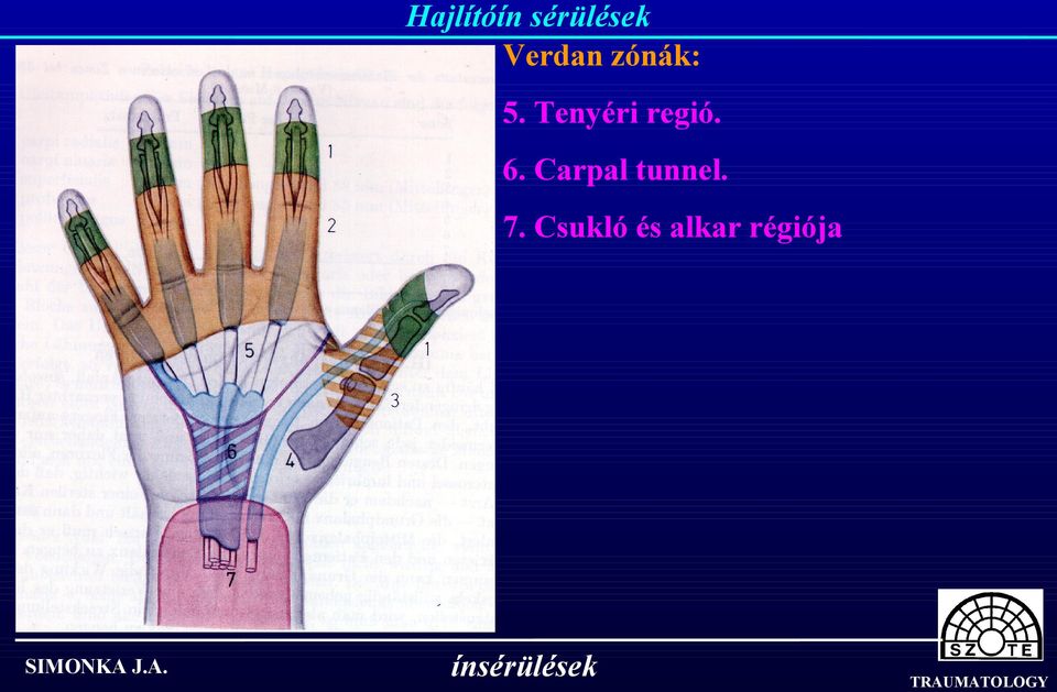 Carpal tunnel. 7.