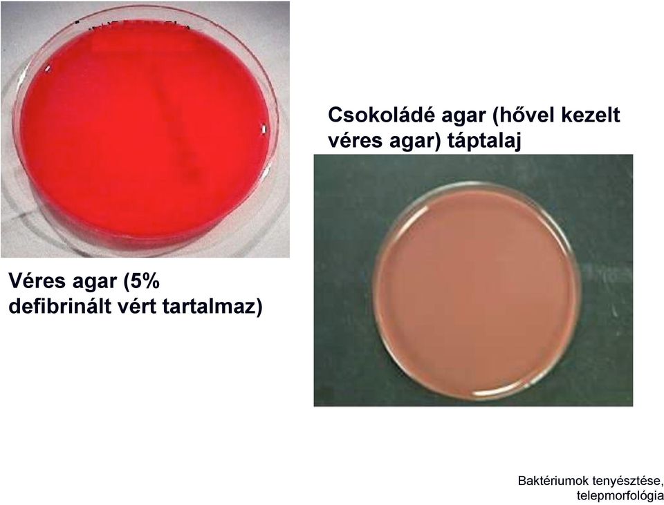 (5% defibrinált vért tartalmaz)