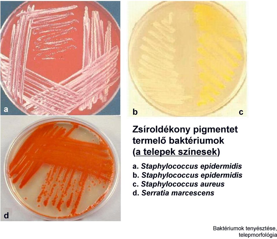 Staphylococcus epidermidis c. Staphylococcus aureus d.