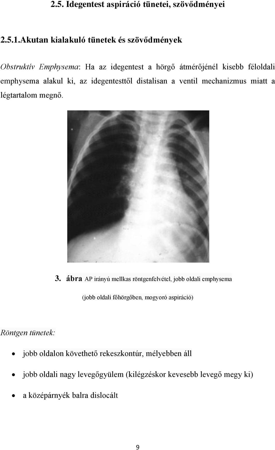 ki, az idegentesttől distalisan a ventil mechanizmus miatt a légtartalom megnő. 3.