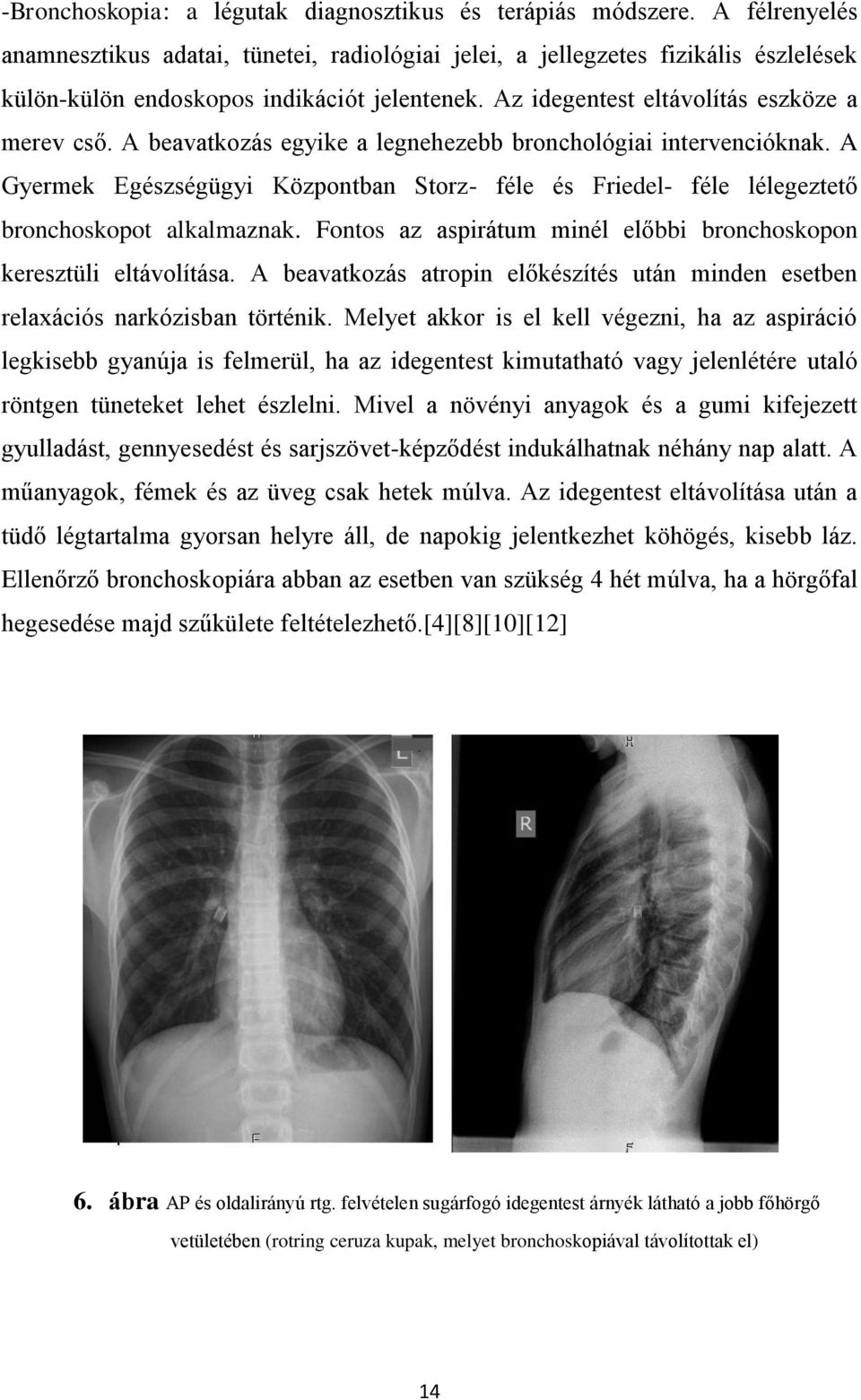 A beavatkozás egyike a legnehezebb bronchológiai intervencióknak. A Gyermek Egészségügyi Központban Storz- féle és Friedel- féle lélegeztető bronchoskopot alkalmaznak.