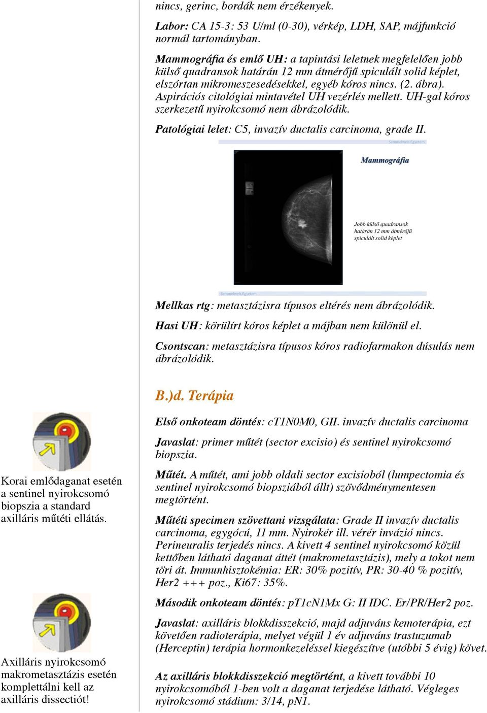 Aspirációs citológiai mintavétel UH vezérlés mellett. UH-gal kóros szerkezetű nyirokcsomó nem ábrázolódik. Patológiai lelet: C5, invazív ductalis carcinoma, grade II.