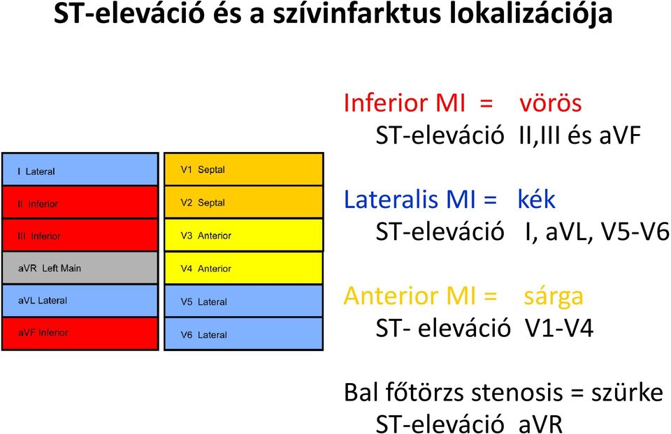 ST-eleváció I, avl, V5-V6 Anterior MI = sárga