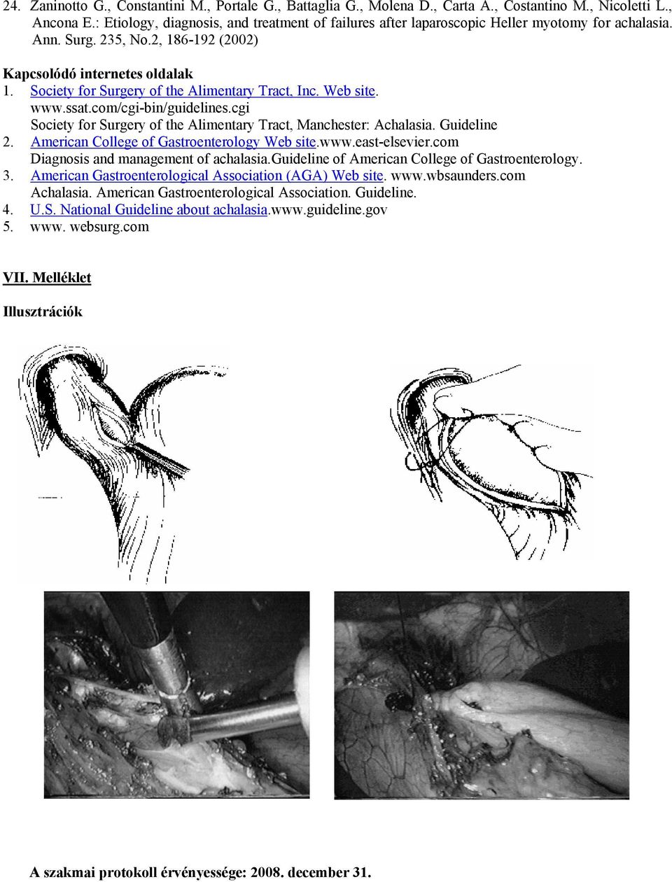 Society for Surgery of the Alimentary Tract, Inc. Web site. www.ssat.com/cgi-bin/guidelines.cgi Society for Surgery of the Alimentary Tract, Manchester: Achalasia. Guideline 2.