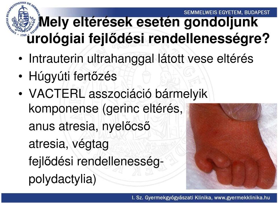 Intrauterin ultrahanggal látott vese eltérés Húgyúti fertızés