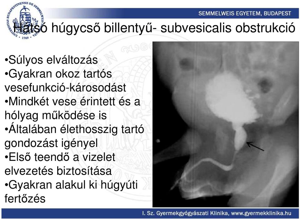 hólyag mőködése is Általában élethosszig tartó gondozást igényel Elsı