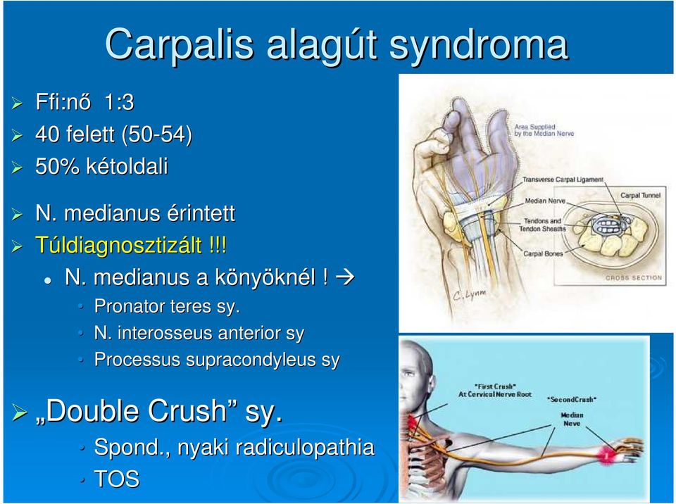 Pronator teres sy. N.