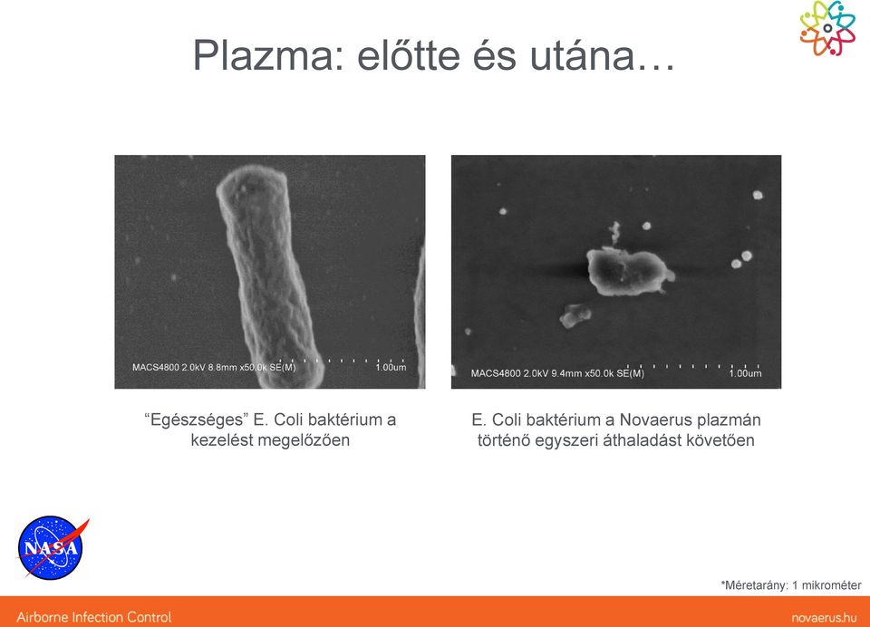 Coli baktérium a Novaerus plazmán történő