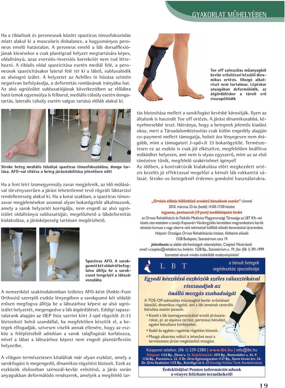 A tibialis oldal spasticitása esetén mediál felé, a peroneusok spasticitásakor lateral felé tér ki a lábtô, subluxalódik az alsóugró ízület.