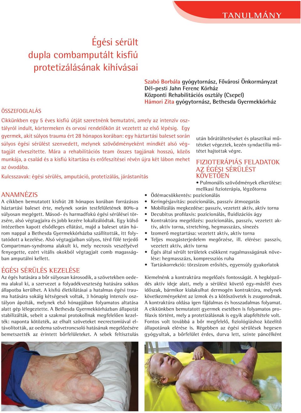 Egy gyermek, akit súlyos trauma ért 28 hónapos korában: egy háztartási bal eset során súlyos égési sérülést szenvedett, melynek szövôd ményeként mind két alsó végtagját elveszítette.