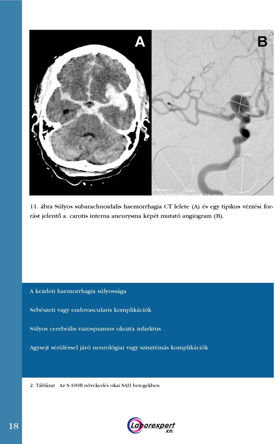 A kezdeti haemorrhagia súlyossága Sebészeti vagy endovascularis komplikációk Súlyos cerebrális