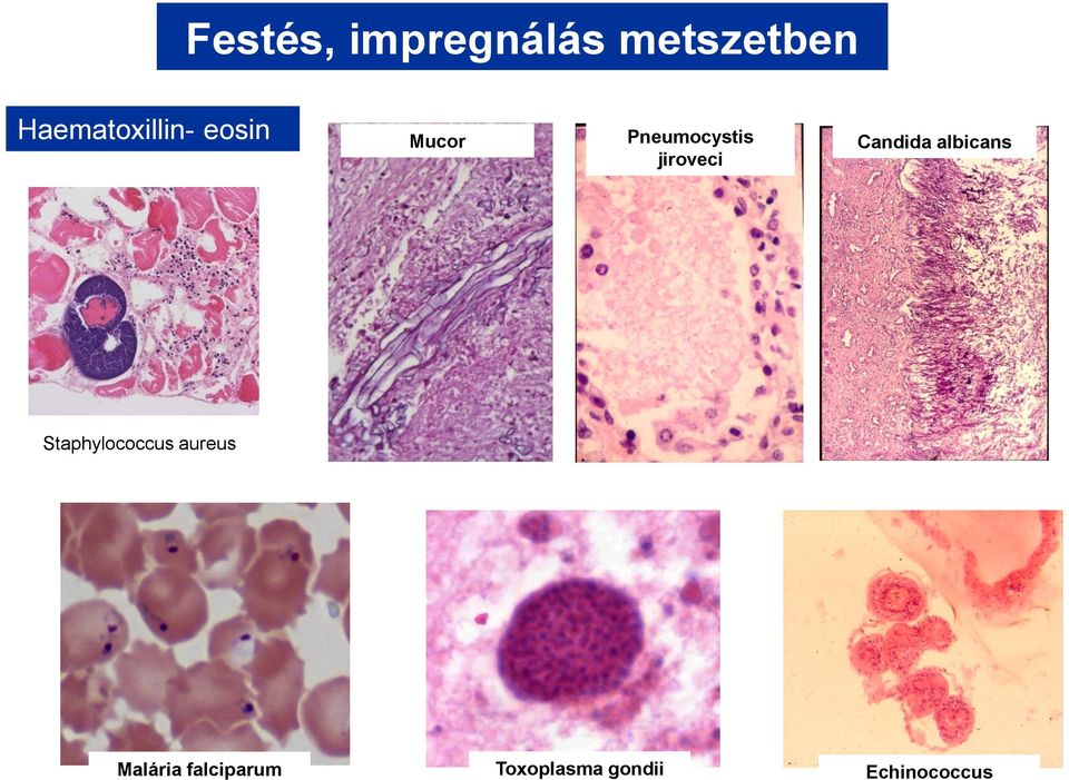 jiroveci Candida albicans Staphylococcus