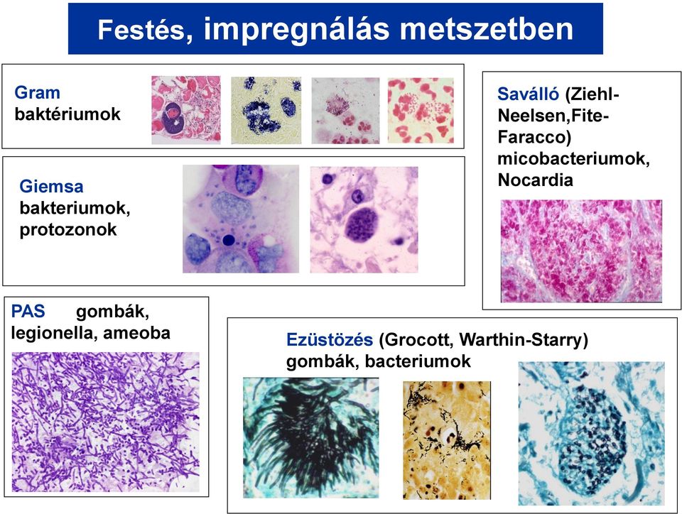 Faracco) micobacteriumok, Nocardia PAS gombák,