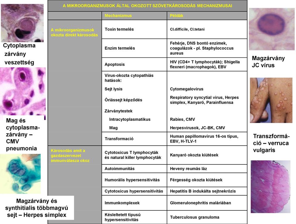 Staphylococcus aureus HIV (CD4+ T lymphocyták); Shigella flexneri (macrophagok), EBV Magzárvány JC vírus Virus-okozta cytopathiás hatások: Sejt lysis Cytomegalovirus Óriássejt képződés Respiratory